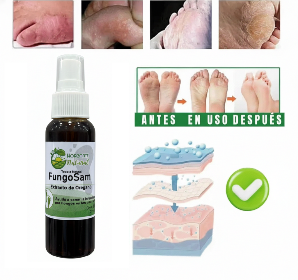 Spray Anti Hongos