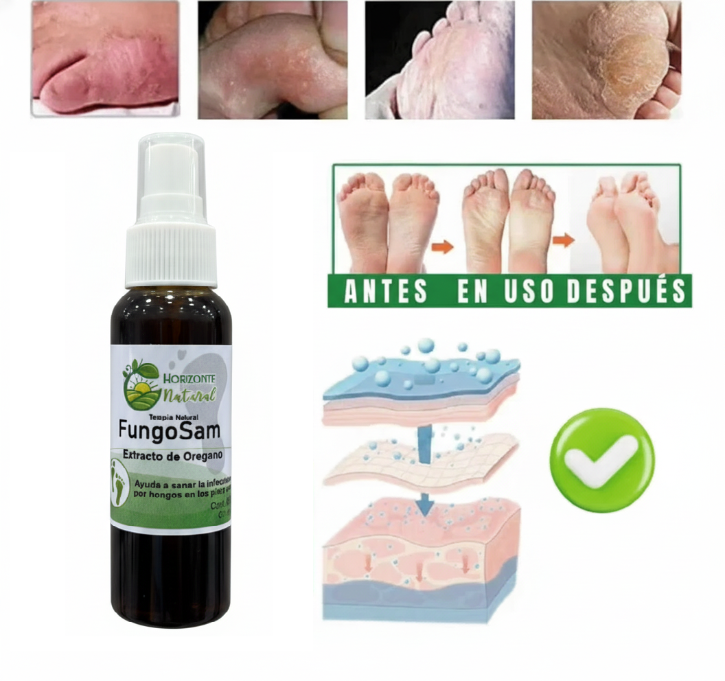 Spray Anti Hongos
