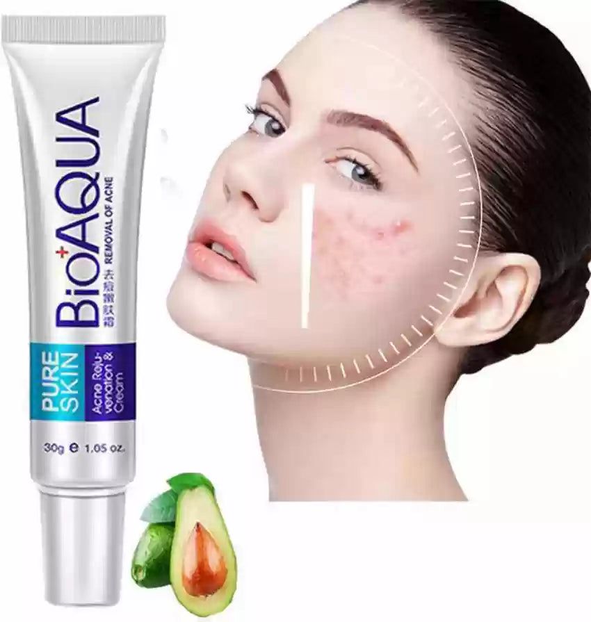 El Eliminador de Acné Definitivo