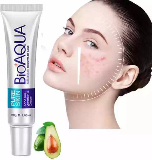 El Eliminador de Acné Definitivo